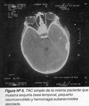 Tac simple Tac simple