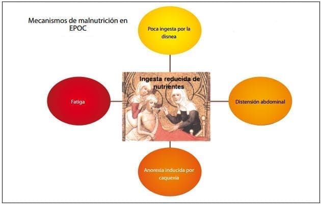 Mecanismos de malnutrición en EPOC. Ingesta reducida de nutrientes Mecanismos de malnutrición en EPOC. Ingesta reducida de nutrientes