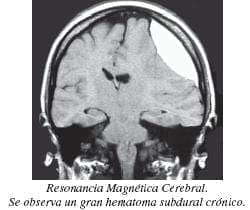 Resonancia magnética