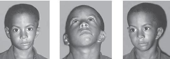 Transcurrido el primer año Transcurrido el primer año