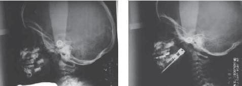 Cefalometria Cefalometria