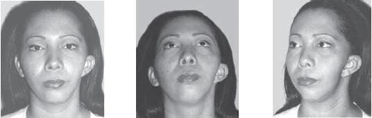 Después de transcurrido un año Después de transcurrido un año