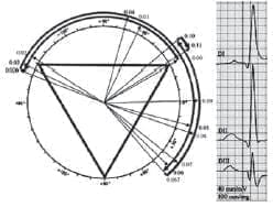 Ángulos de vectores potencial de  MAW