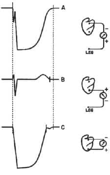 Articulo de sugarman