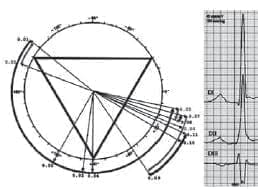 Ángulos de vectores potencial de MAA