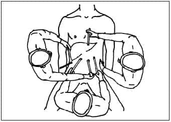 Configuración del Equipo de Trabajo. El Cirujano se Localiza entre las Piernas del Paciente Configuración del Equipo de Trabajo. El Cirujano se Localiza entre las Piernas del Paciente