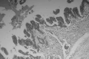 Estudio Histopatológico de Páncreas Utilizando Coloraciones de Hematoxilina Eosina