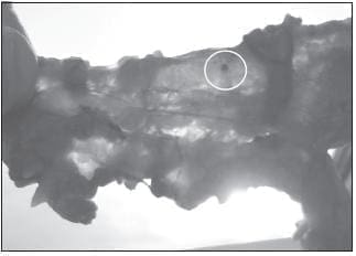 El Tejido Aclarado Permite la Identificación a Trasluz de las Estructuras Ganglionares  El Tejido Aclarado Permite la Identificación a Trasluz de las Estructuras Ganglionares