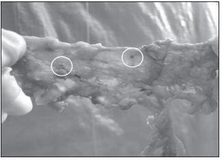 El Azul de Metileno Permite, Además, Identificar los Ganglios