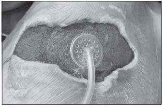 Aspecto de la Herida Compleja durante el Tratamiento