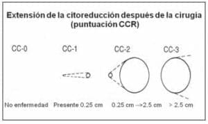 Extensión de la Citorreducción después de la Cirugía Extensión de la Citorreducción después de la Cirugía