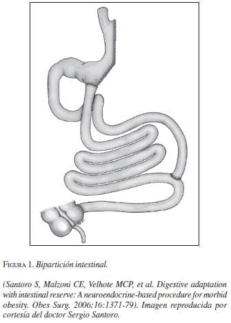 Bipartición Intestinal
