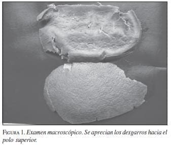 Examen Macroscópico