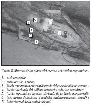 Muestra de los Planos Escroto y el Cordón Espermático Muestra de los Planos Escroto y el Cordón Espermático