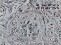 Células fusiformes Células fusiformes