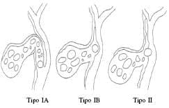 Clasificación de Starling