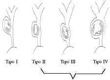  Clasificación de A. Csendez.