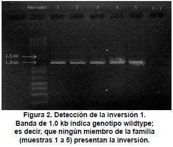 Genética Molecular, Detección de la inversión 1 Genética Molecular, Detección de la inversión 1