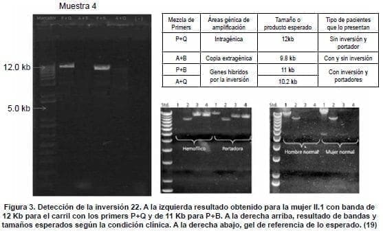 Genética Molecular, Detección de la inversión 22 Genética Molecular, Detección de la inversión 22