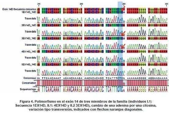 Polimorfismo en el exón 14 de tres miembros de la familia Polimorfismo en el exón 14 de tres miembros de la familia