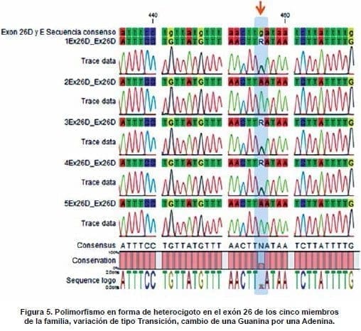 Polimorfismo en Forma de Heterocigoto en el Exón 26 Polimorfismo en Forma de Heterocigoto en el Exón 26