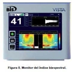 Monitor del Índice Biespectral Monitor del Índice Biespectral