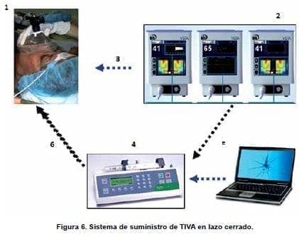 Sistema de suministro de TIVA en lazo cerrado Sistema de suministro de TIVA en lazo cerrado
