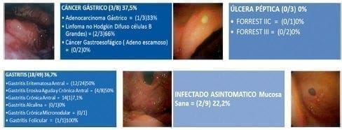 Frecuencia H. pylori por PCR