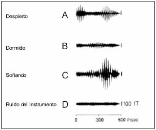 Magnetoencefalografía Magnetoencefalografía