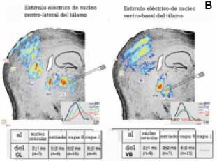 Imagen voltaje sensitiva Imagen voltaje sensitiva