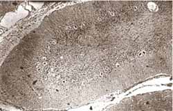 Folia cerebelosa Folia cerebelosa