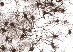 Folia cerebelosa Folia cerebelosa