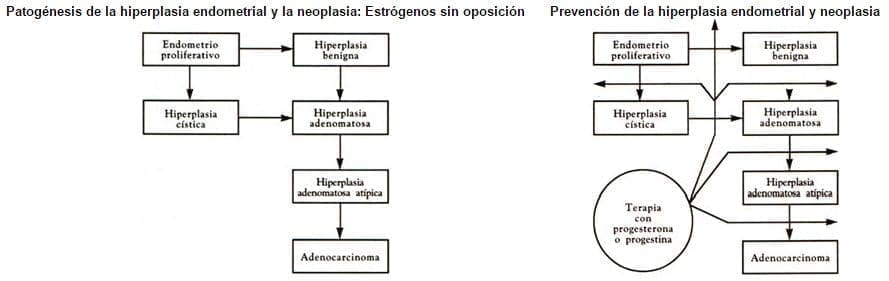 Hiperplasia Endometrial Cáncer Hiperplasia Endometrial Cáncer