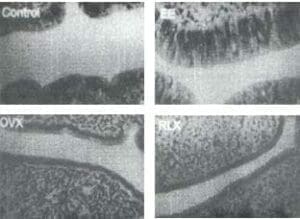 Aspecto del endometrio en ratas ovariectomizadas Aspecto del endometrio en ratas ovariectomizadas