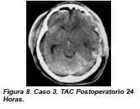 TAC Postoperatorio 24 Horas. TAC Postoperatorio 24 Horas.