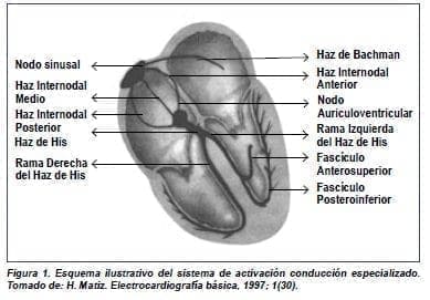 Sistema de Activación Conducción Especializado