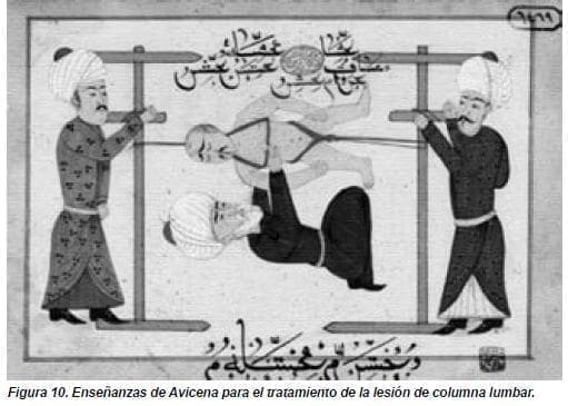 Enseñanzas de Avicena para el tratamiento de la lesión de columna lumbar Enseñanzas de Avicena para el tratamiento de la lesión de columna lumbar