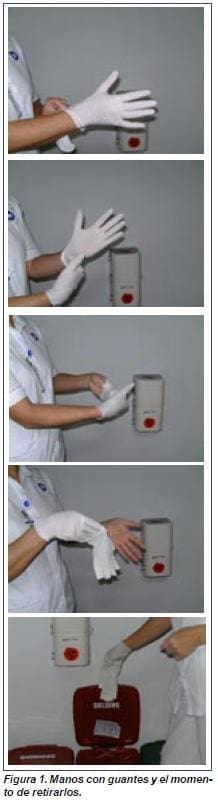 Mano con Guantes y el Momentos de Retirarlos