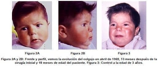 Control a la edad de 3 Años