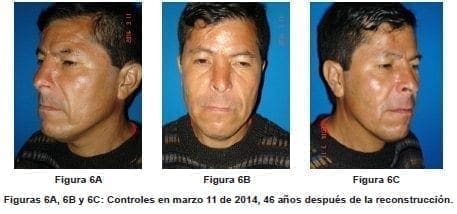 Estado Actual después de 46 años