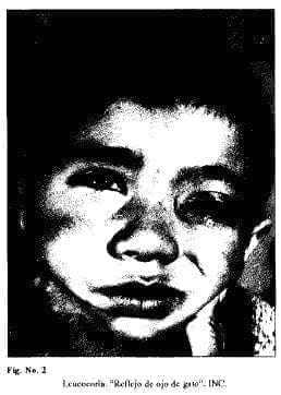 Leucocona Renejo de ojo de gato Leucocona Renejo de ojo de gato