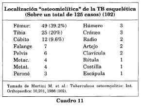 Localización osteomielitica Localización osteomielitica