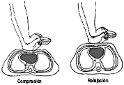 Maniobras de Compresión Relajación Maniobras de Compresión Relajación
