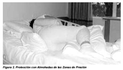 Protección con Almohadas de las Zonas de Presión Protección con Almohadas de las Zonas de Presión - Cuidado de Enfermería en Lesiones de Piel