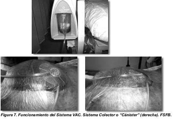 Funcionamiento del Sistema VAC Funcionamiento del Sistema VAC