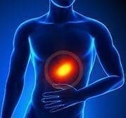 Reflujo-Gastroesofagico1