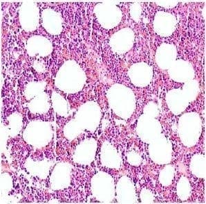 Componente adiposo y el hematopoyético