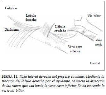 Vista lateral derecha del proceso Caudado Vista lateral derecha del proceso Caudado