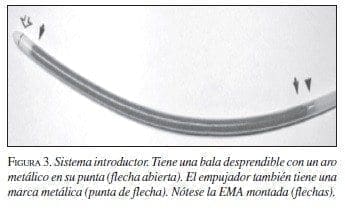 Endoprótesis Metálicas, Sistema Introductor Endoprótesis Metálicas, Sistema Introductor