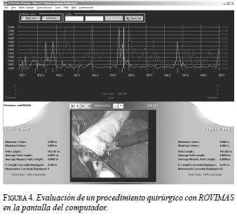Sistema da Vinci: Evaluación de un procedimiento quirúrgico con ROVIMAS Sistema da Vinci: Evaluación de un procedimiento quirúrgico con ROVIMAS